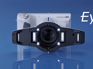 口腔内カメラ　歯科専用設計写真