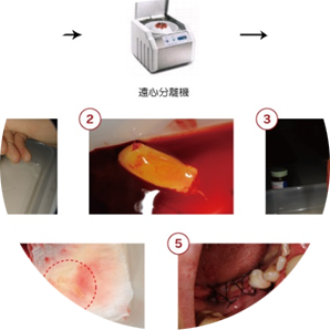再生療法イメージ