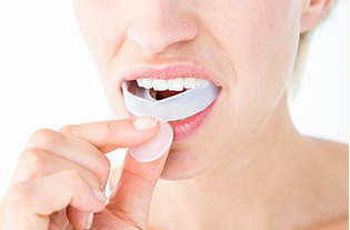 マウスピースイメージ